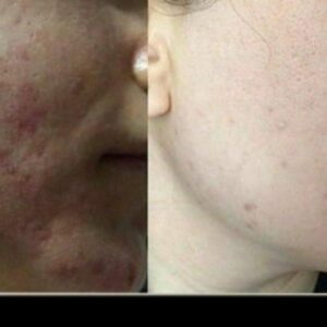 فرمول کرم وی ای پی